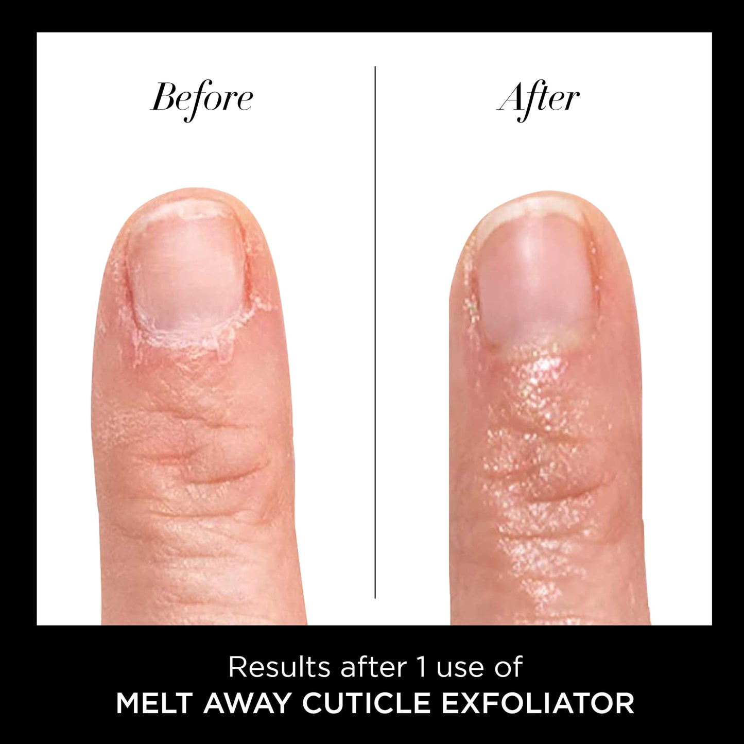 butter LONDON Cuticle Remover Liquid, Melt Away - Cuticle Oil Exfoliator & Softener Gently Removes Dry, Overgrown Cuticles for Healthy Looking Nails - Fast-Acting & Pain-Free Formula - 0.4 Fl Oz