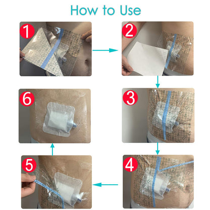 Waterproof Shower Bandage Protector [Pack of 50], 6"x8" Dialysis Catheter Shower Cover Wound PD Peritoneal Dialysis Chemo Port Chest Feeding Tube G-Tube PICC Line Film Dressing